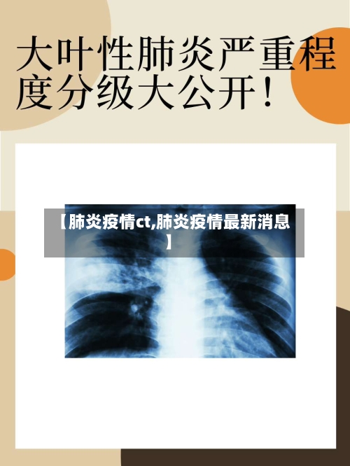 【肺炎疫情ct,肺炎疫情最新消息】-第2张图片